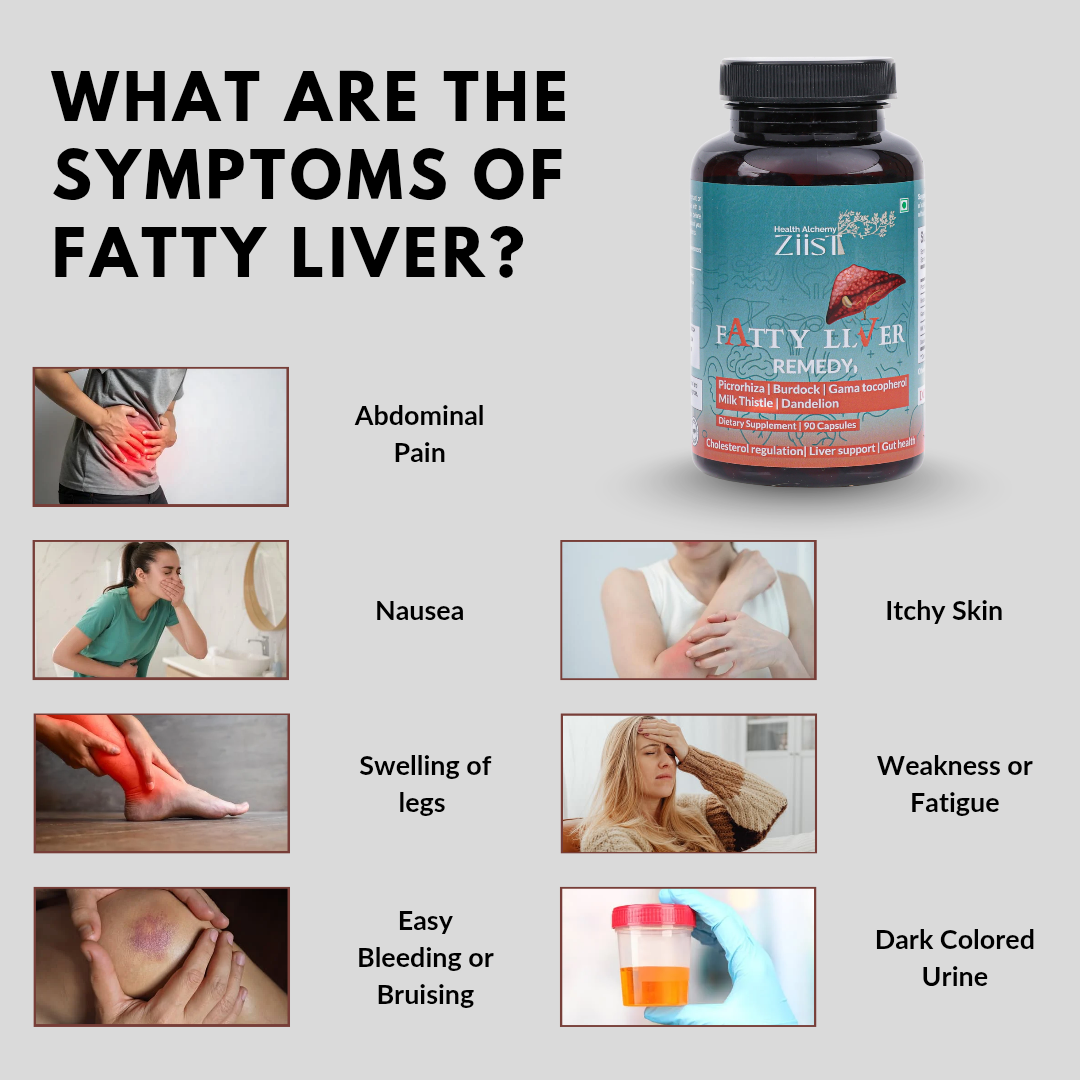Fatty Liver Remedy 1200mg per serving